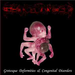 Laryngectomized - Grotesque Deformities & Congenital Disorders download free