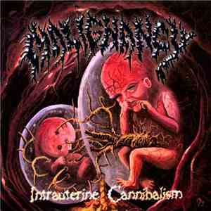 Malignancy - Intrauterine Cannibalism download free