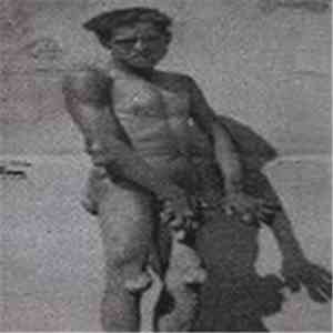 ze'rØ-sum - Xantelasma Tuberoso download free